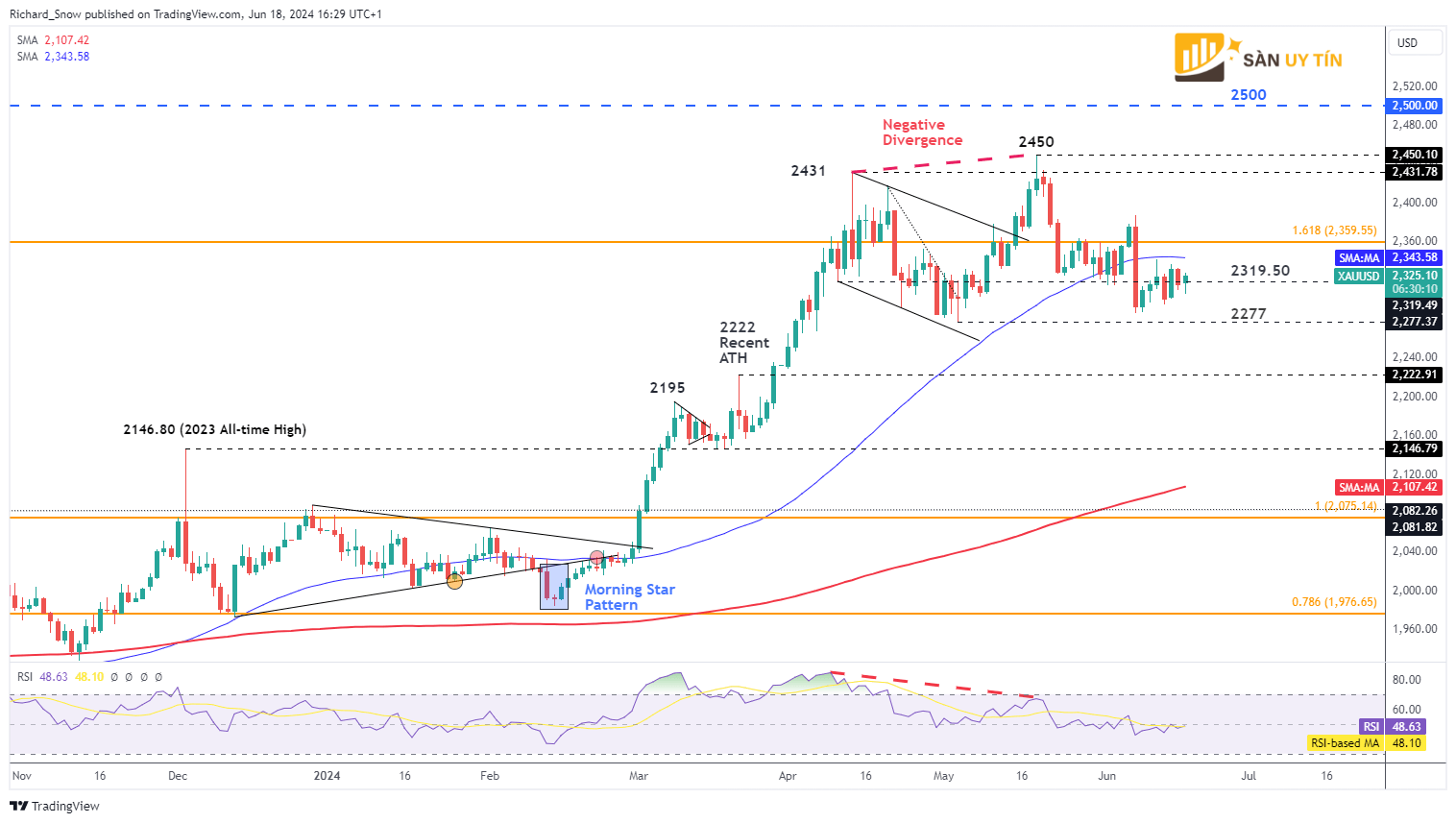 Bieu do hang ngay vang XAUUSD